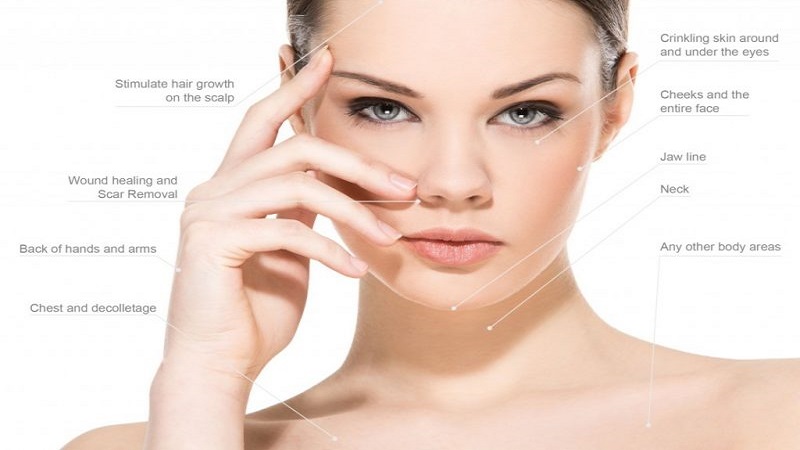 PRP (پی آر پی)