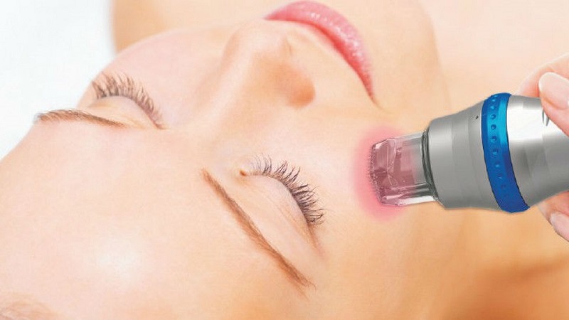 ار اف فرکشنال