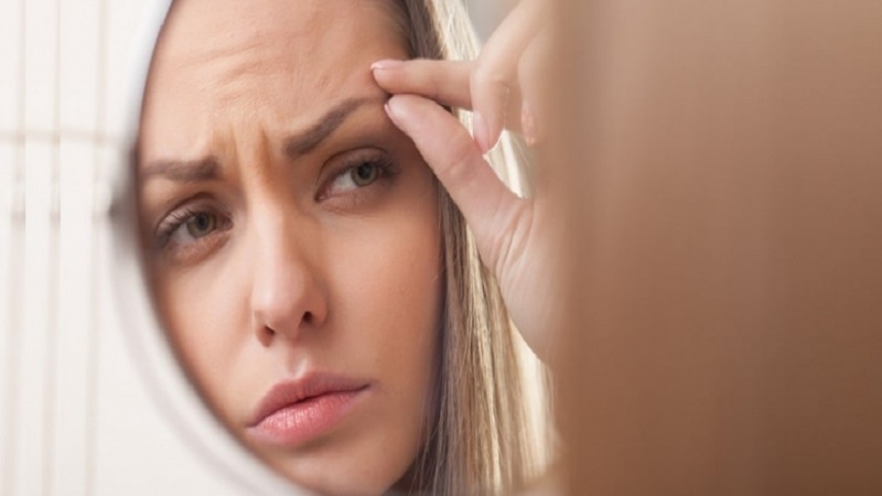 فیلر دم ابرو