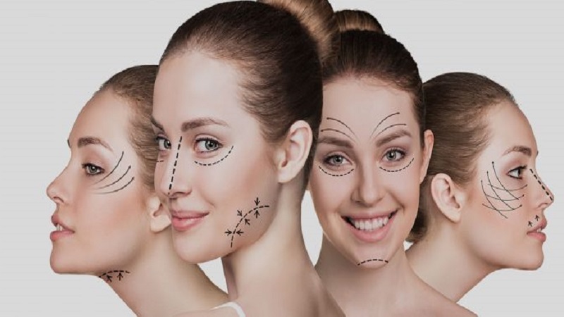 مزوتراپی غبغب