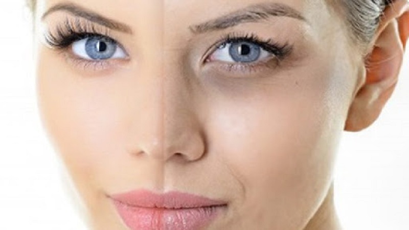 کربوکسی تراپی