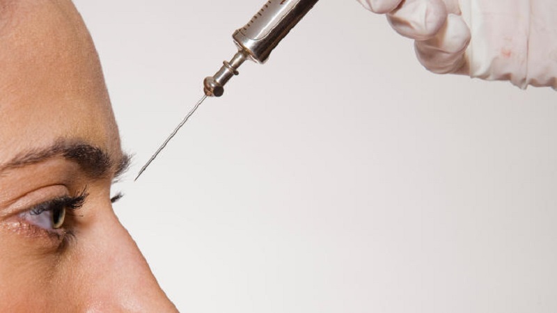 هزینه و قیمت زیبایی بینی بدون جراحی