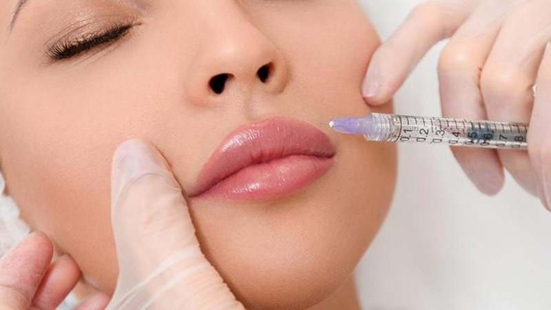 تزریق ژل لب چیست ؟