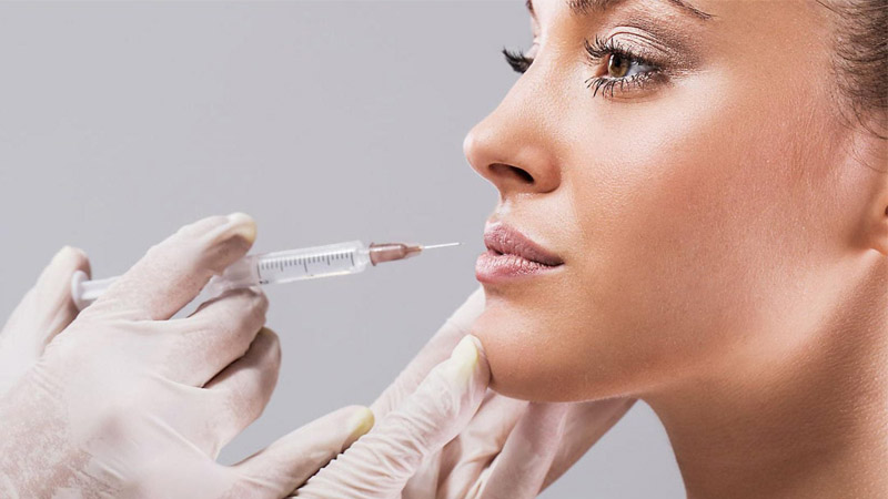 فیلر چیست ؟