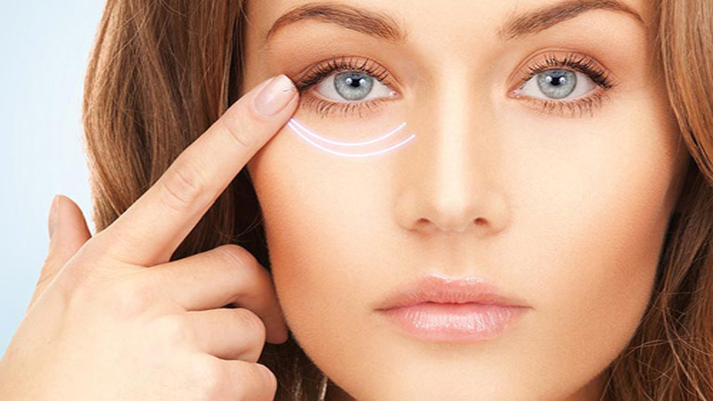 فیلر زیر چشم در اصفهان