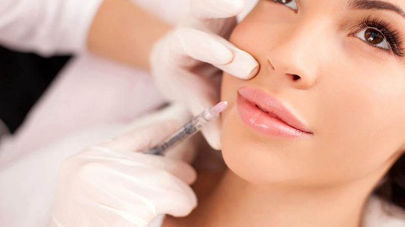 انواع ژل رووفيل