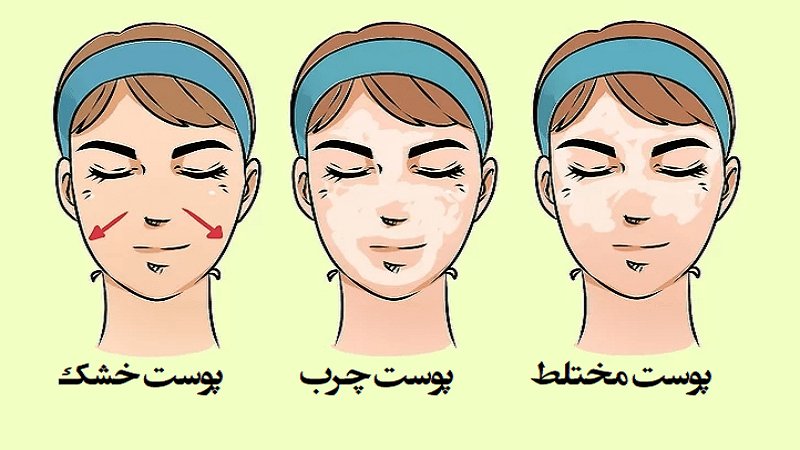 بهترین پزشک زیبایی اصفهان | نحوه مراقبت از پوست مختلط