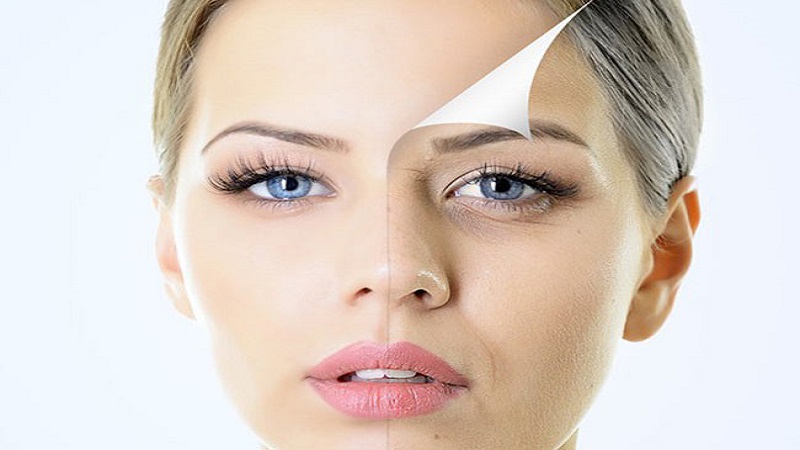 دوره نقاهت جوانسازی پوست | پزشک زیبایی اصفهان