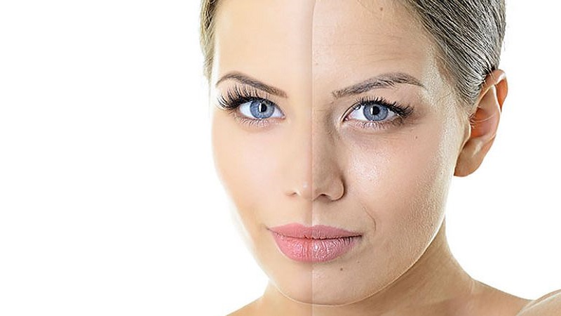 دوره نقاهت جوانسازی پوست