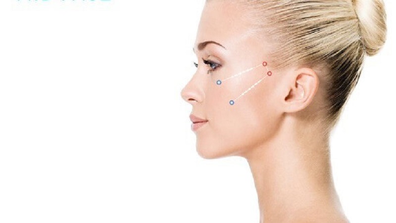 مزوژل در اصفهان | لیفت با نخ در اصفهان | تزریق بوتاکس در اصفهان | دکتر مجید حسینی