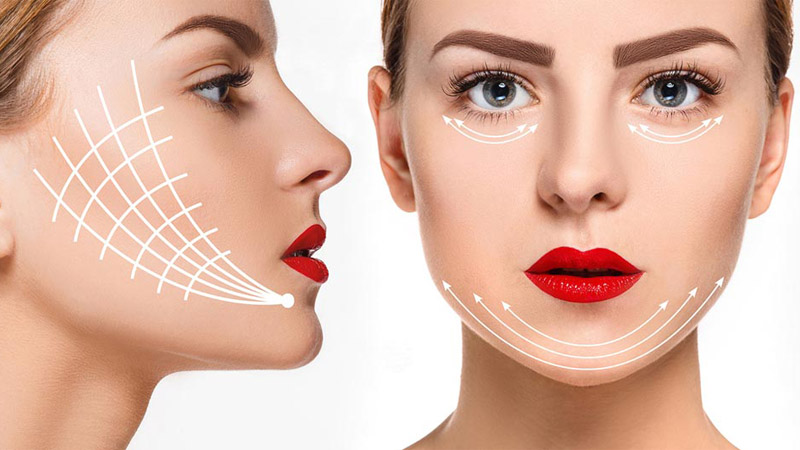 مناسب ترین کاندید لیفت با نخ سیلوئت