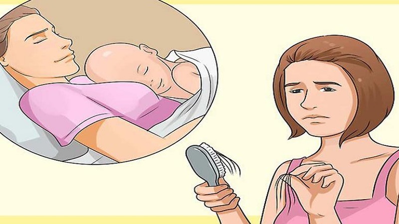 دلایل و پیشگیری ریزش مو در دوران شیردهی