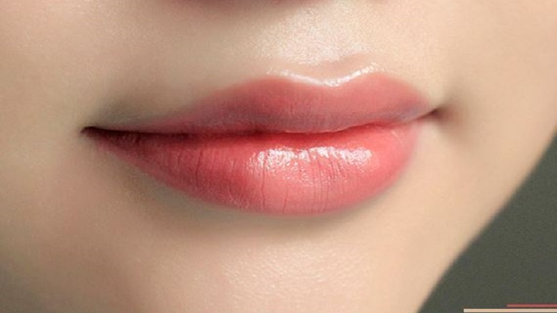 تزریق ژل لب مدل سه دکمه‌ای