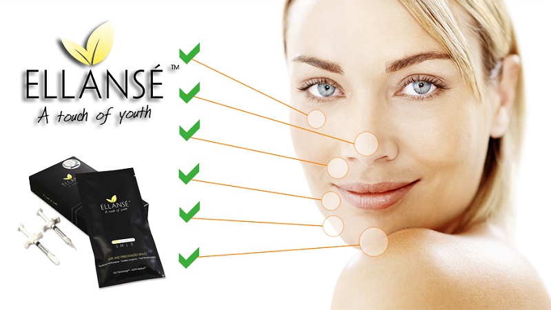 ژل الانسه و مزایای آن