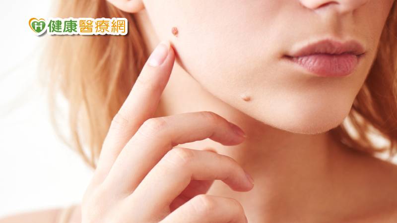 علل و درمان منگوله‌ی پوستی