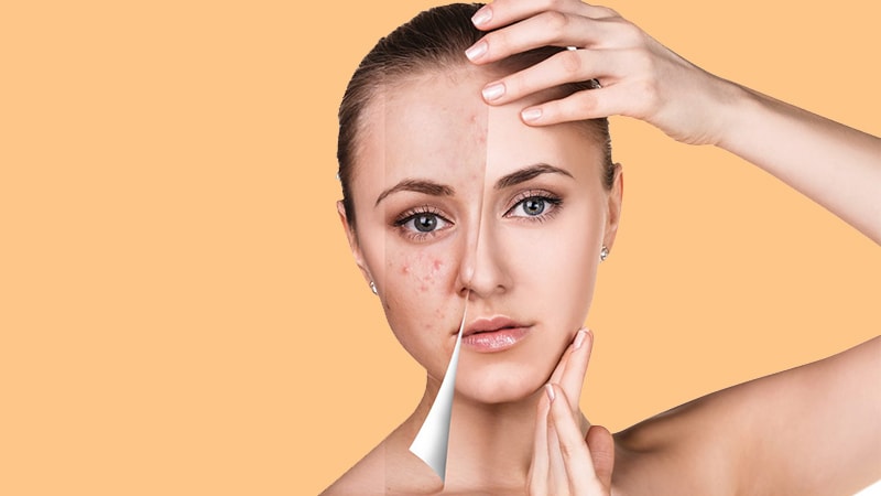 بررسی مشکلات رایج پوستی در بارداری | پزشک زیبایی اصفهان