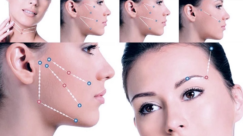 ساختار و مکانیسم عمل نخ سیلوئت