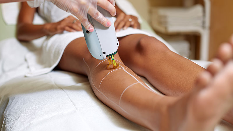 مزوژل در اصفهان | لیفت با نخ در اصفهان | تزریق بوتاکس در اصفهان | دکتر مجید حسینی