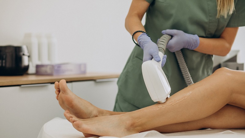 نگرانی های لیزر موهای زائد