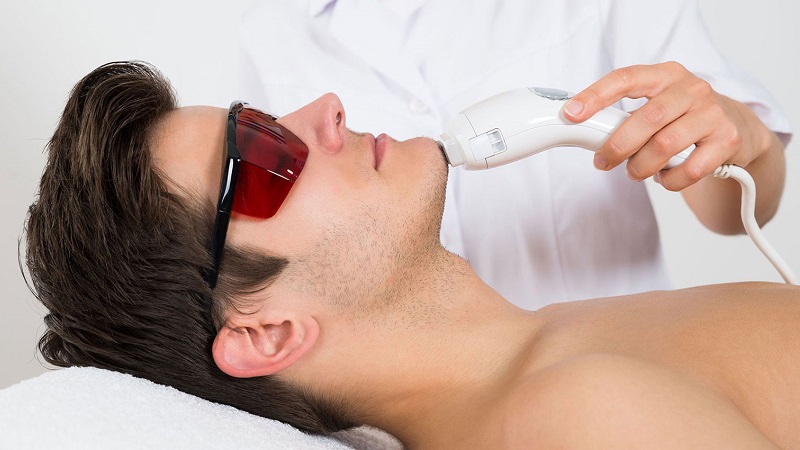 چگونگی لیزر موهای زائد چانه