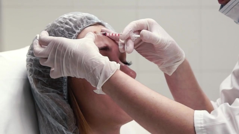 مراقبت های لازم برای تزریق فیلر خط خنده