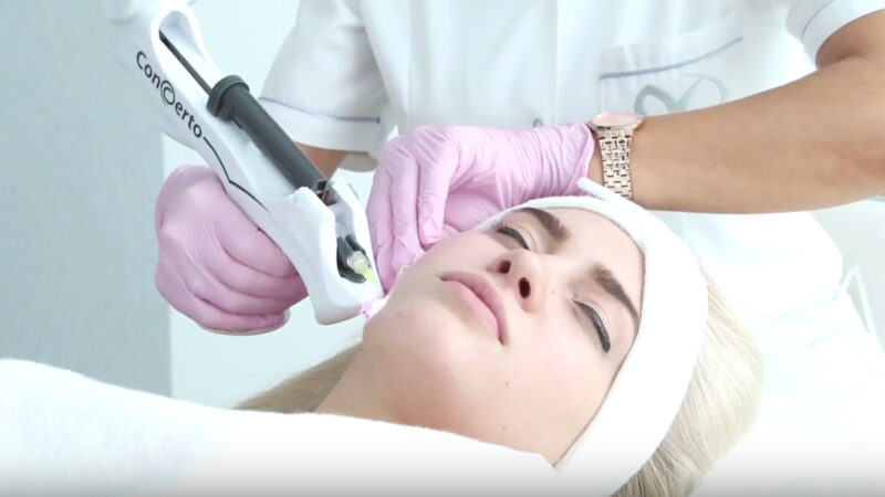 مزایا و معایب کربوکسی تراپی | پزشک زیبایی اصفهان