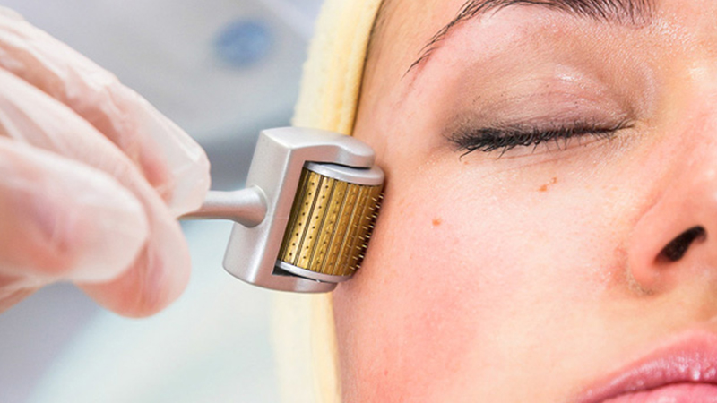 اقدامات قبل و بعد از میکرونیدلینگ