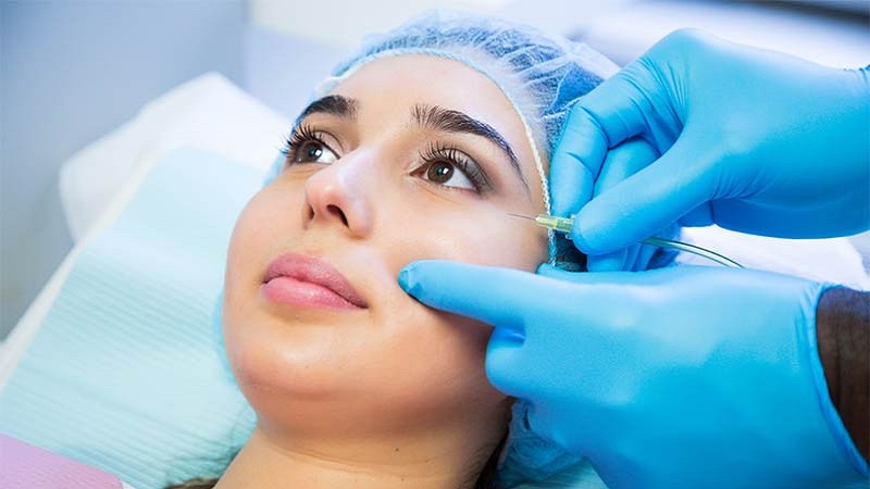 درمان تیرگی و گودی زیر چشم با کربوکسی تراپی