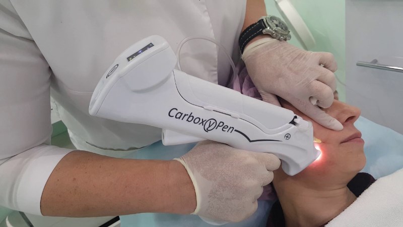 نکات مراقبتی قبل و بعد از کربوکسی تراپی