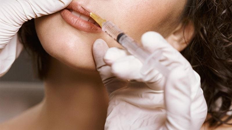 مزایا و معایب تزریق ژل لب