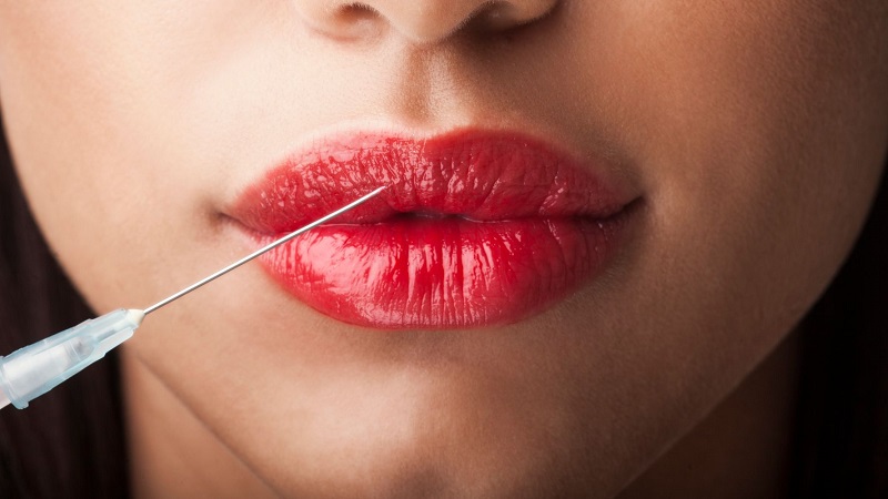 کاربرد انواع مختلف ژل لب