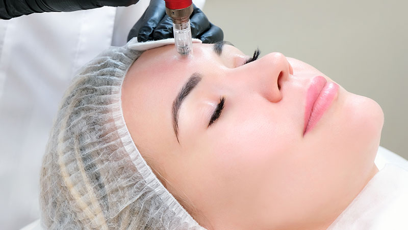 کاربردهای میکرونیدلینگ