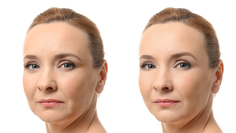 بهترین راه های جوانسازی پوست