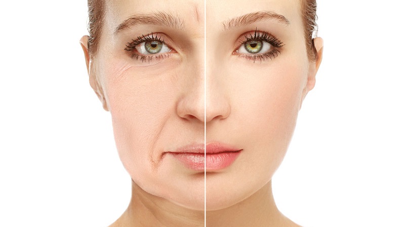 راه های جلوگیری از پیری پوست