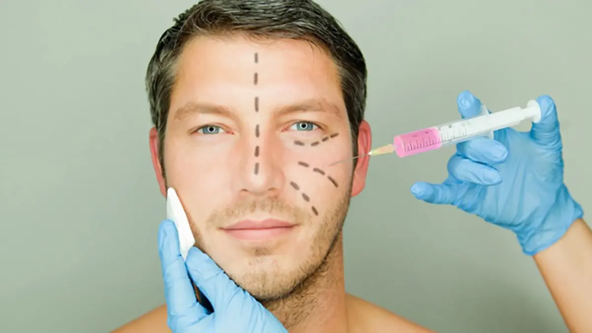 نمونه تزریق فیلر فرم مردانه