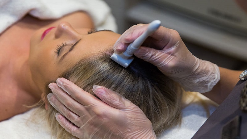 نمونه تزریق prp مو همراه میکرونیدل