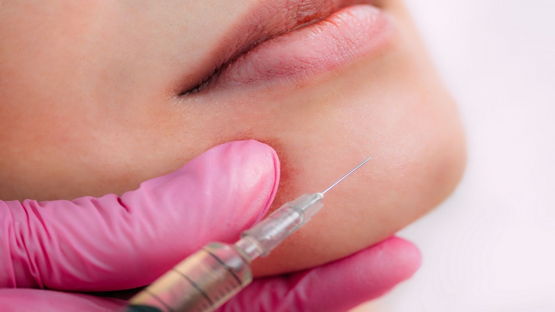 مزوژل در اصفهان | لیفت با نخ در اصفهان | تزریق بوتاکس در اصفهان | دکتر مجید حسینی