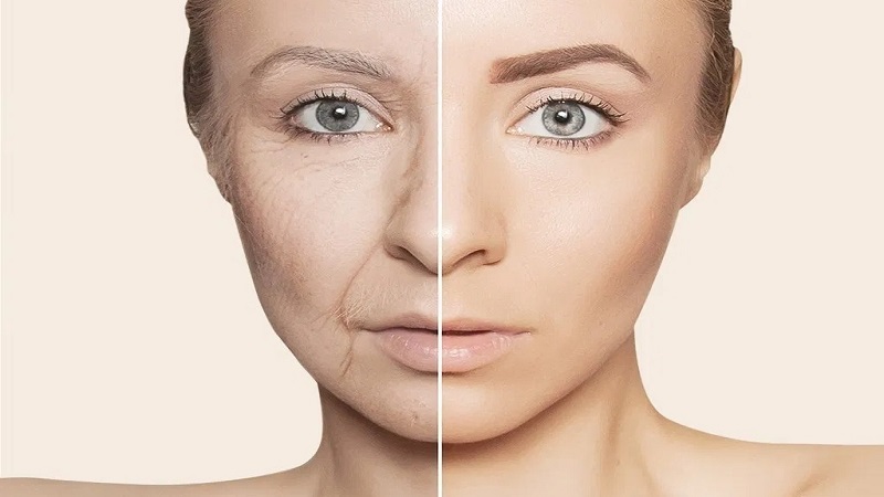 راهنمای جامع رفع افتادگی صورت با تزریق فیلر