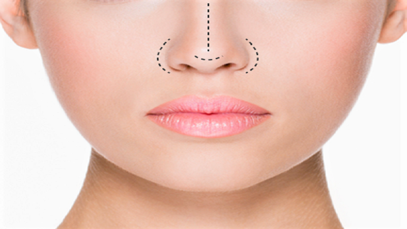 پلاسمای بینی | پزشک زیبایی اصفهان | دکتر مجید حسینی 