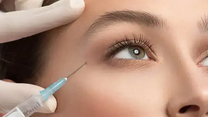 نکاتی برای تزریق بوتاکس دور چشم