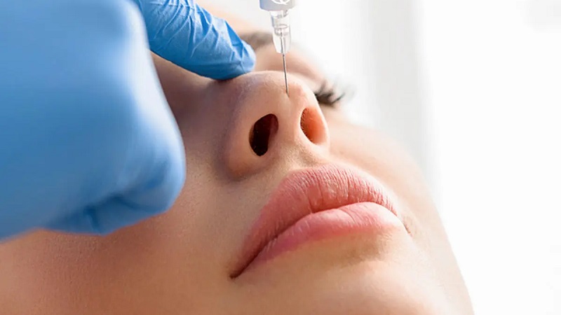 اصلاح تیغه بینی با تزریق فیلر