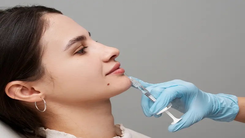 نمونه اصلاح عقب بودن چانه توسط دکتر مجید حسینی