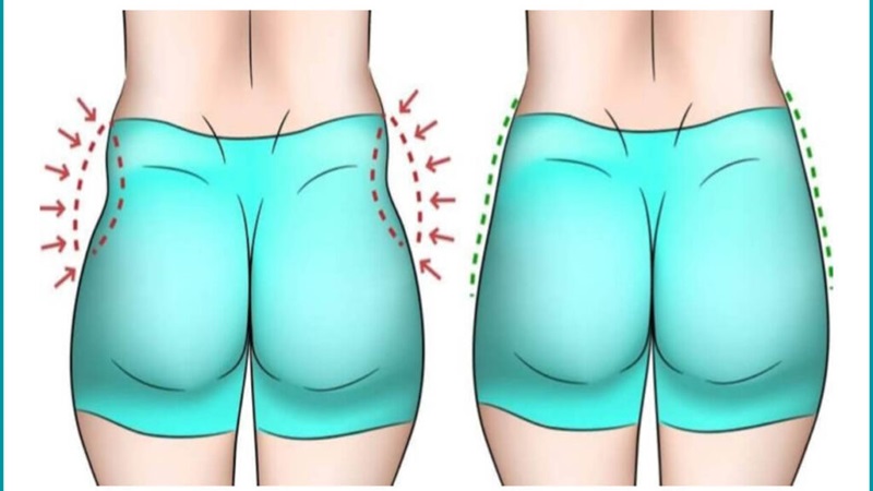آشنایی با تزریق هیپ دیپ (Hip Dip)
