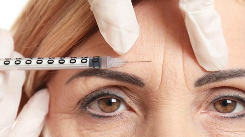سوالات متداول درباره تزریق بوتاکس