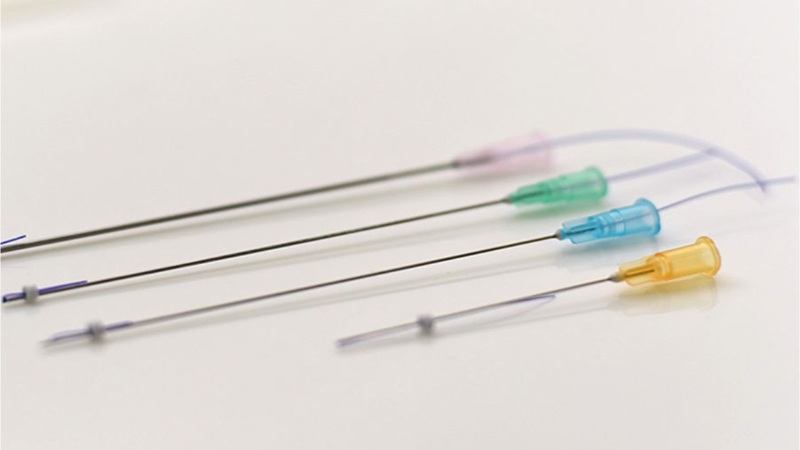 انواع نخ‌های مورد استفاده در لیفت صورت