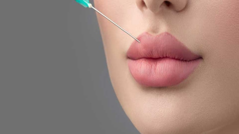 ژل لب کی طبیعی می‌شود؟