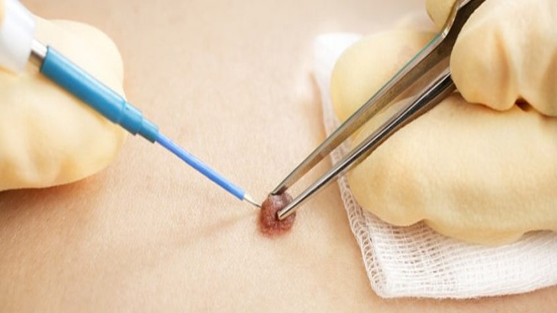 مزوژل در اصفهان | لیفت با نخ در اصفهان | تزریق بوتاکس در اصفهان | دکتر مجید حسینی