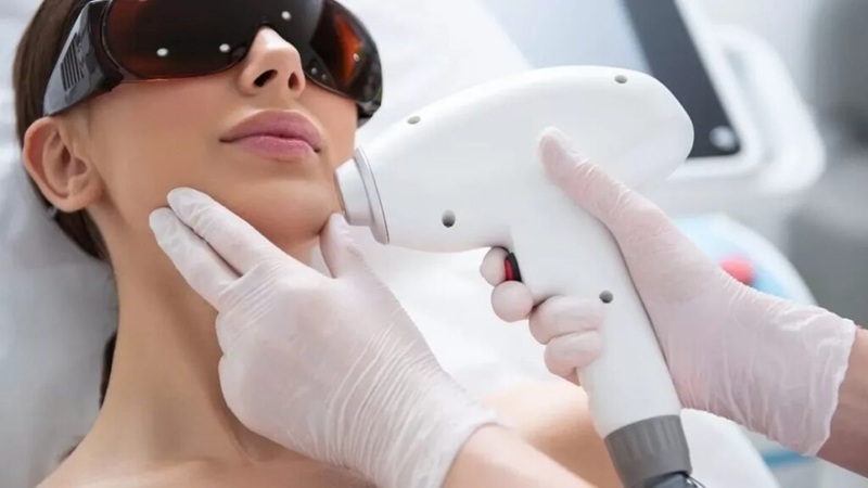 آیا لیزر موی زائد دائمیه؟