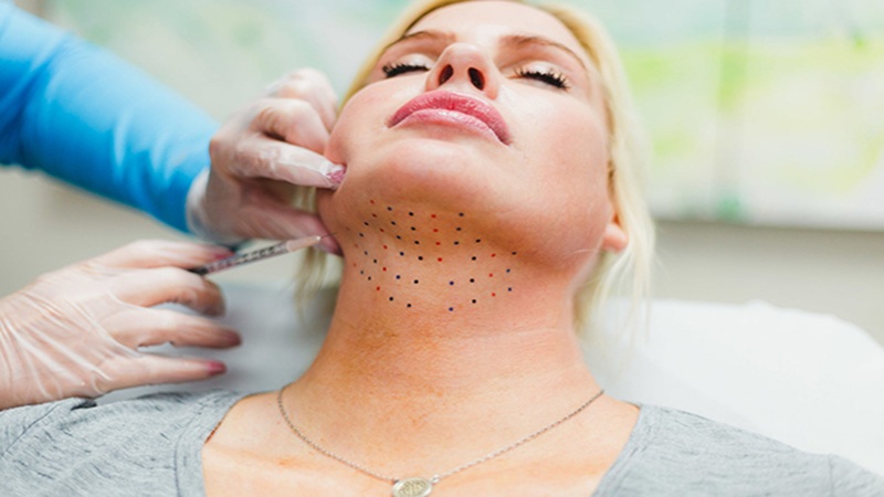 مزوژل در اصفهان | لیفت با نخ در اصفهان | تزریق بوتاکس در اصفهان | دکتر مجید حسینی