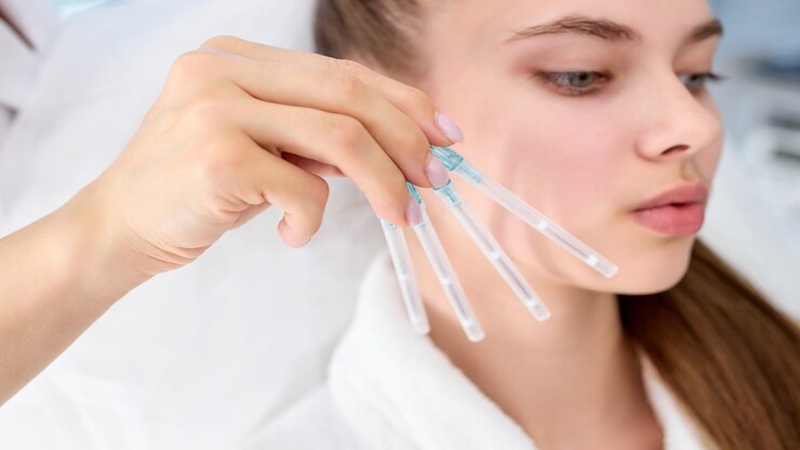 تکنیک‌های جدید در لیفت با نخ